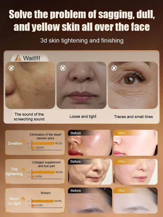 🔥Hot Sale 50% Off🔥💦Lingzhi Anti-wrinkle Rejuvenating Water💦🔥BUY 1 GET 1 FREE! 🔥