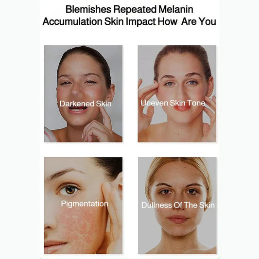 🎉Hot Sale🎉Radiant Skin & Spot Correcting Spray|Buy 1 Get 1 Free 💗